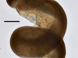 Stephanomia amphytridis image