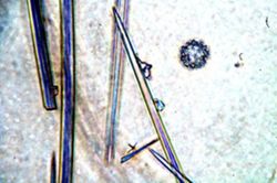 Rhabdastrella fibrosa image