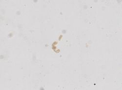 Strongyloides stercoralis image