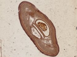 Amphiporus formidabilis image