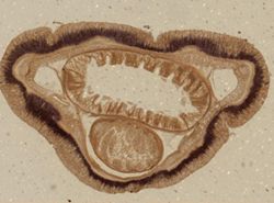 Tubulanus polymorphus image