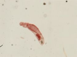Dinophilus gyrociliatus image