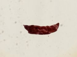 Echinostoma revolutum image