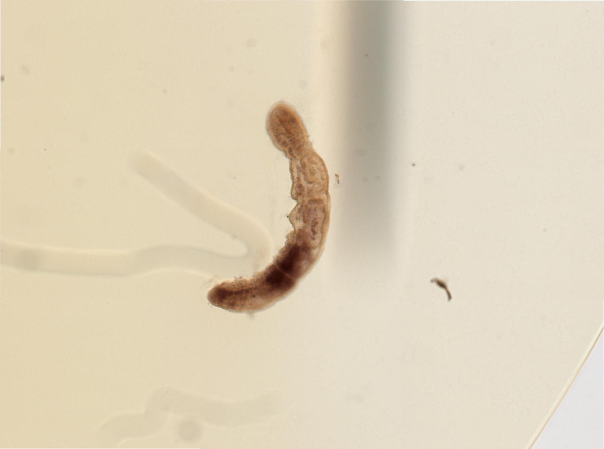 Chaetogaster limnaei image