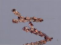 Scrupocellaria scruposa image