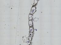 Schizoporella unicornis image