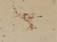 Amathia gracilis image