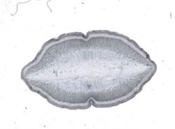 Ligula intestinalis image
