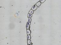 Schizoporella unicornis image