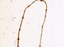 Bothriocephalus scorpii image