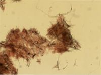 Halichondria bowerbanki image