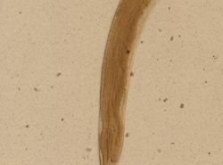 Necator americanus image