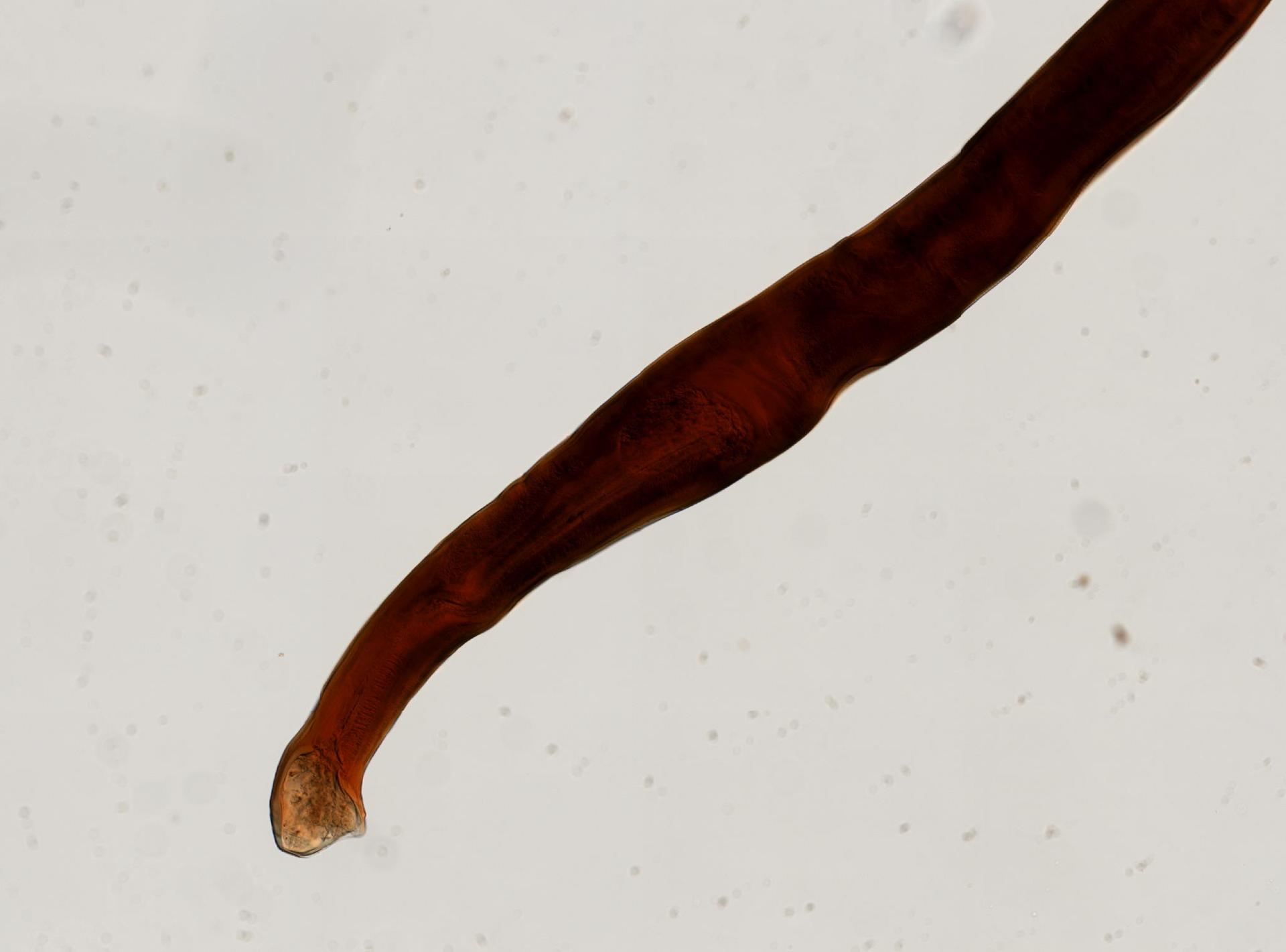 Bunostomum trigonocephalum image