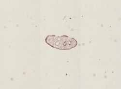 Dicrocoelium dendriticum image