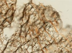 Callyspongia vaginalis image