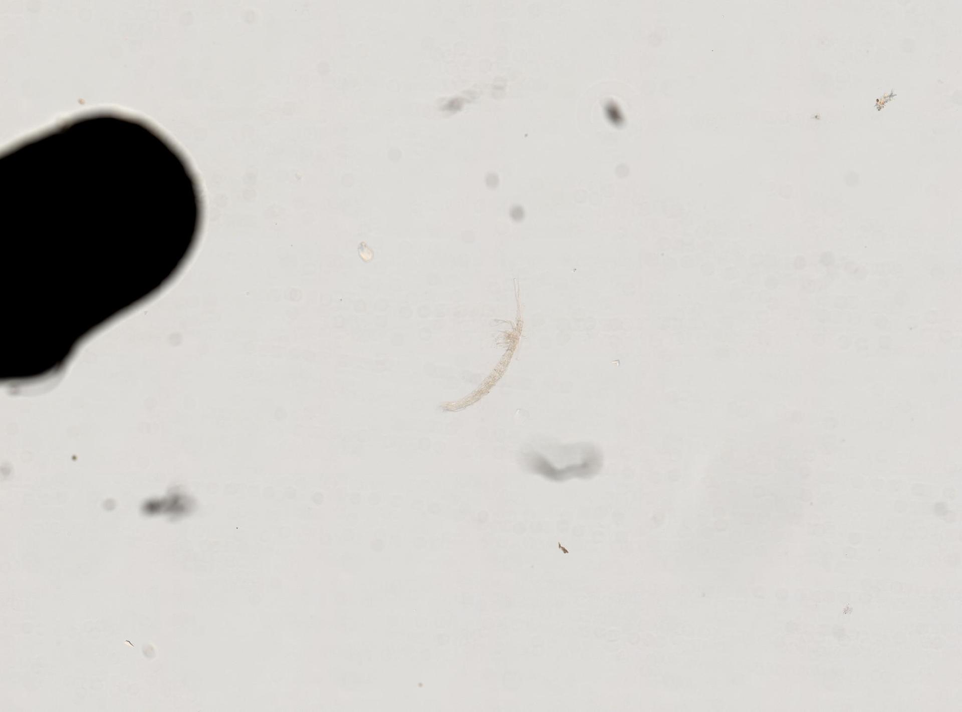 Derocheilocaris typica image