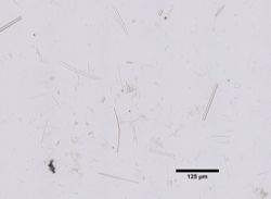 Callyspongia strongylophora image