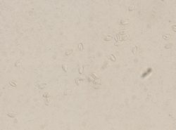Enterobius vermicularis image
