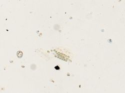 Schistosoma mansoni image