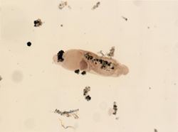 Dinophilus gyrociliatus image