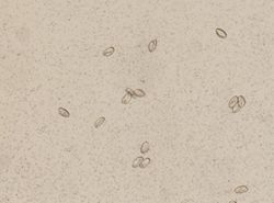 Enterobius vermicularis image