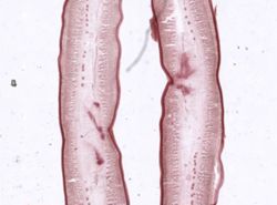 Ligula intestinalis image