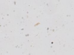 Strongyloides stercoralis image