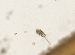 Schistosoma mansoni image