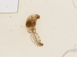 Chaetogaster limnaei image
