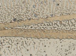 Cyanea capillata image