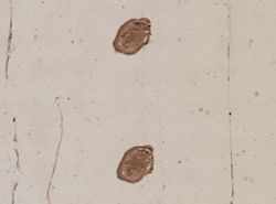 Cephalothrix linearis image