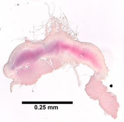 Limnodriloides medioporus image