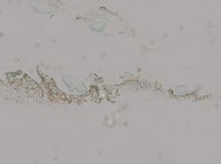 Plakortis zyggompha image