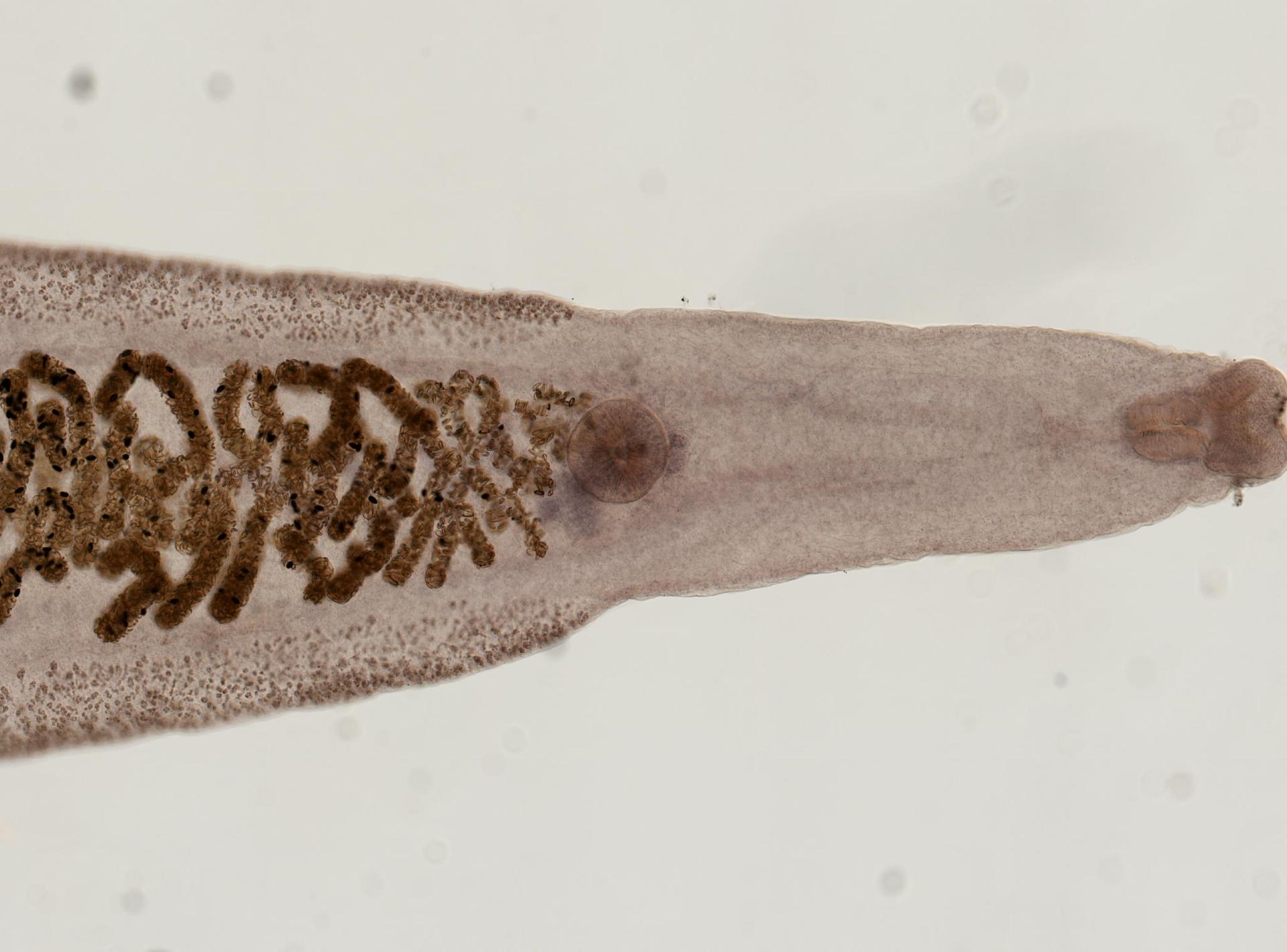Clonorchis sinensis image