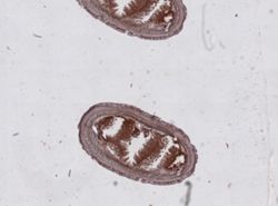 Amphiporus formidabilis image