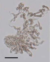 Rosacea cymbiformis image