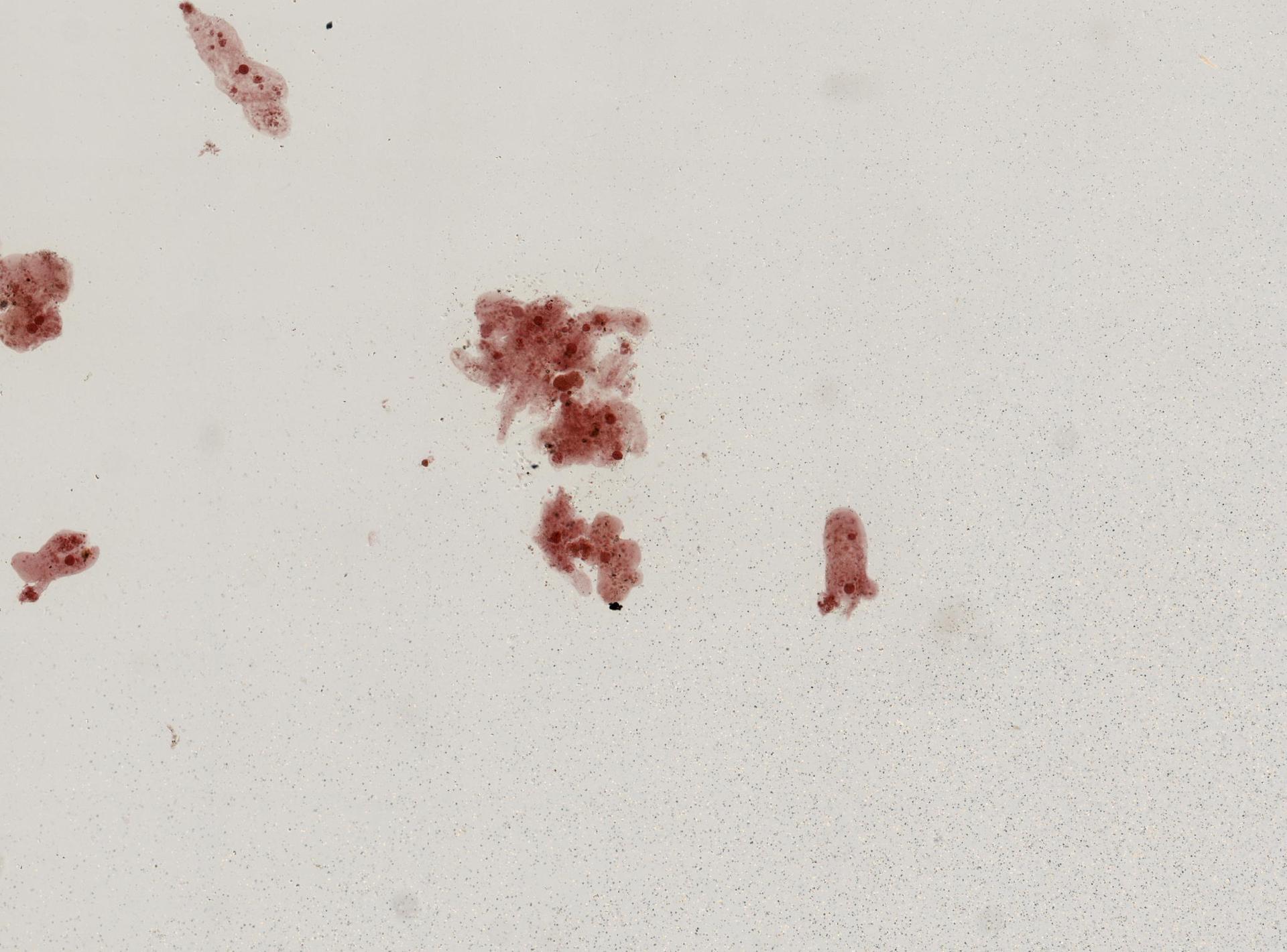 Amoeba proteus image