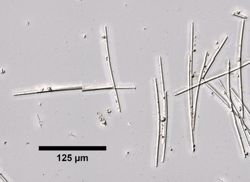Calcifibrospongia actinostromarioides image