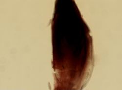 Macracanthorhynchus ingens image