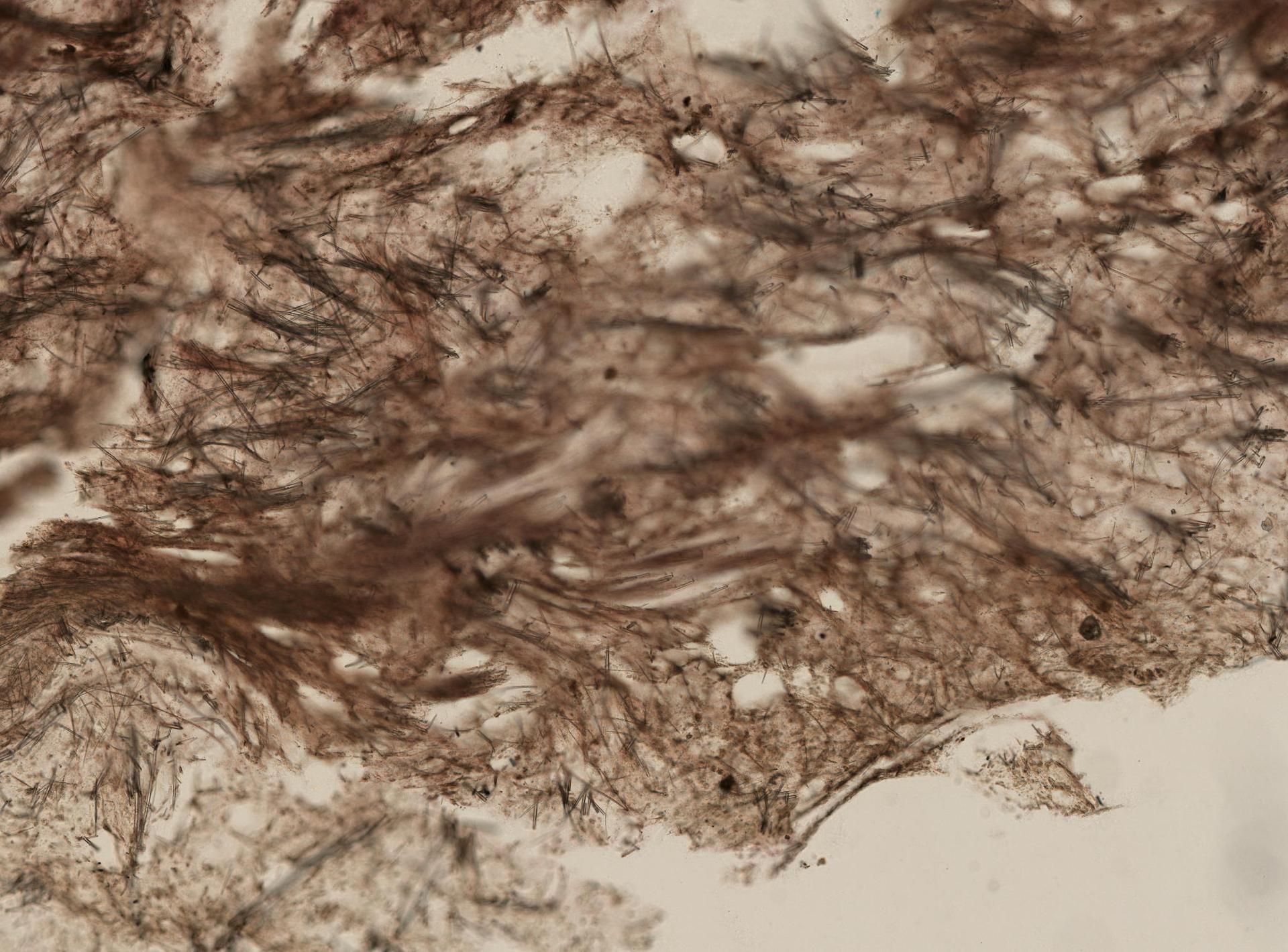 Myrmekioderma granulatum image
