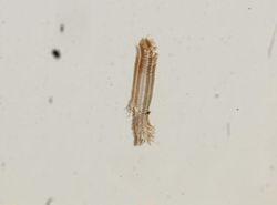 Somatogyrus subglobosus image