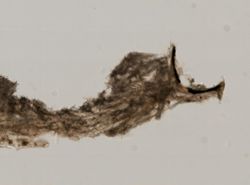 Hamacantha hyaloderma image