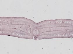 Dibothriocephalus latus image