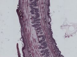 Gyrocotyle fimbriata image