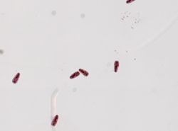 Fasciola hepatica image
