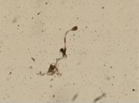 Barentsia gracilis image