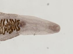 Clonorchis sinensis image