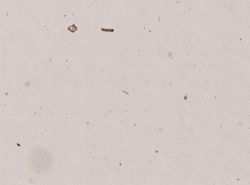 Leptosynapta roseola image
