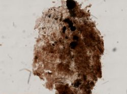 Coelosphaera raphidifera image