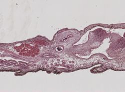 Thysanozoon nigrum image